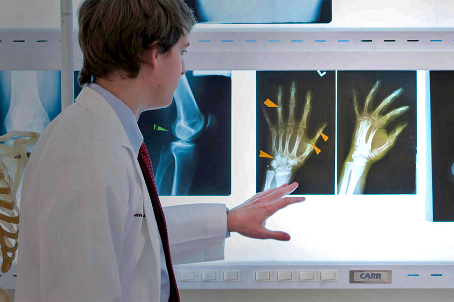 A student doctor inspects an x-ray of a hand in two positions.